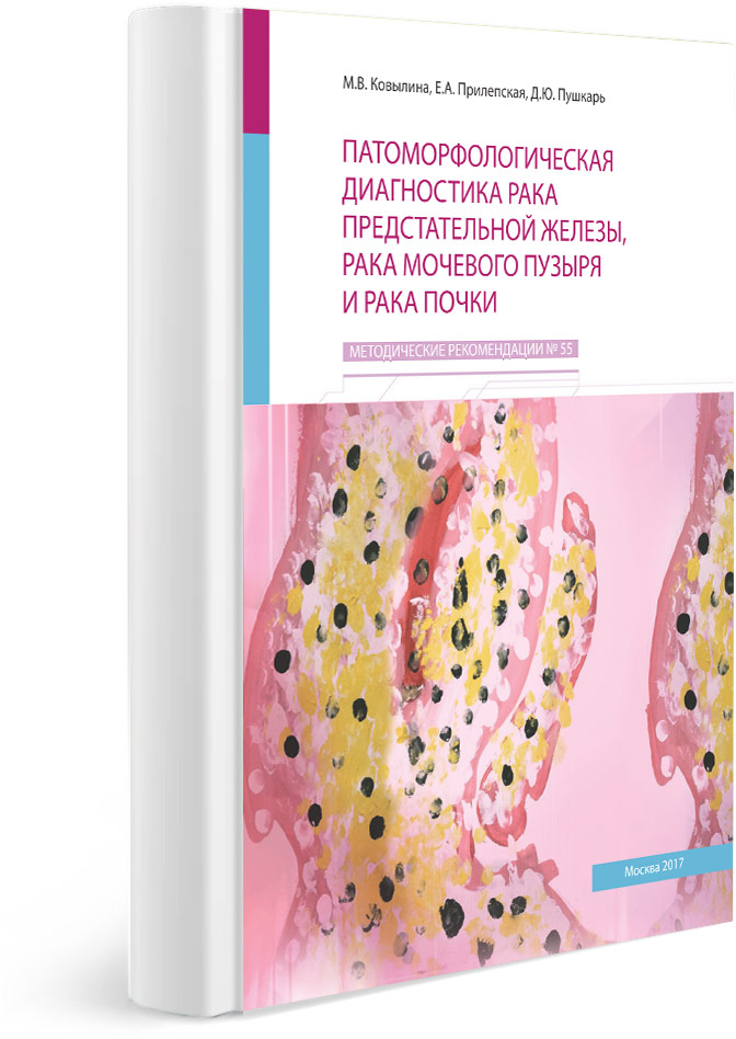 Патоморфологическая диагностика рака предстательной железы, рака мочевого пузыря и рака почки